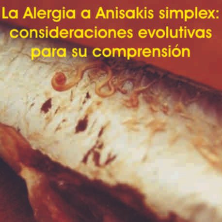 Anisakis